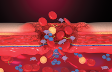 Active bleeding into the digestive lumen