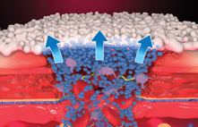 Water absorption