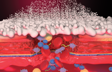 Application of Hemospray